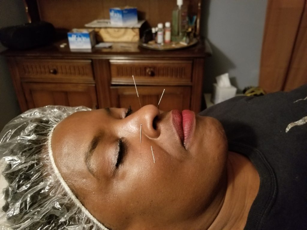 acupuncturist in Chattanooga